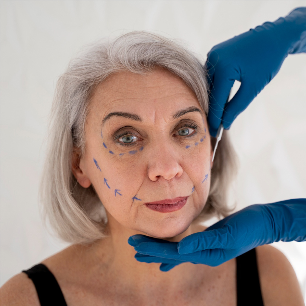 Facelift o Cirugía de rejuvenecimiento facial